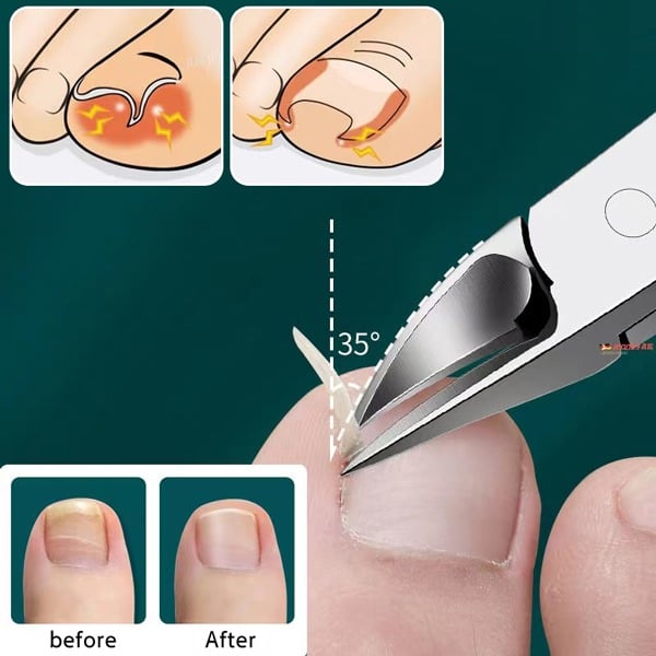 Coupe-ongles Cumuul