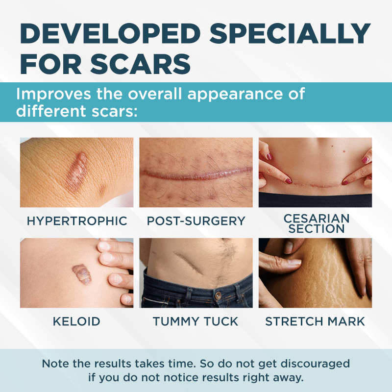 ClearScar™ Gel réducteur de cicatrices avancé