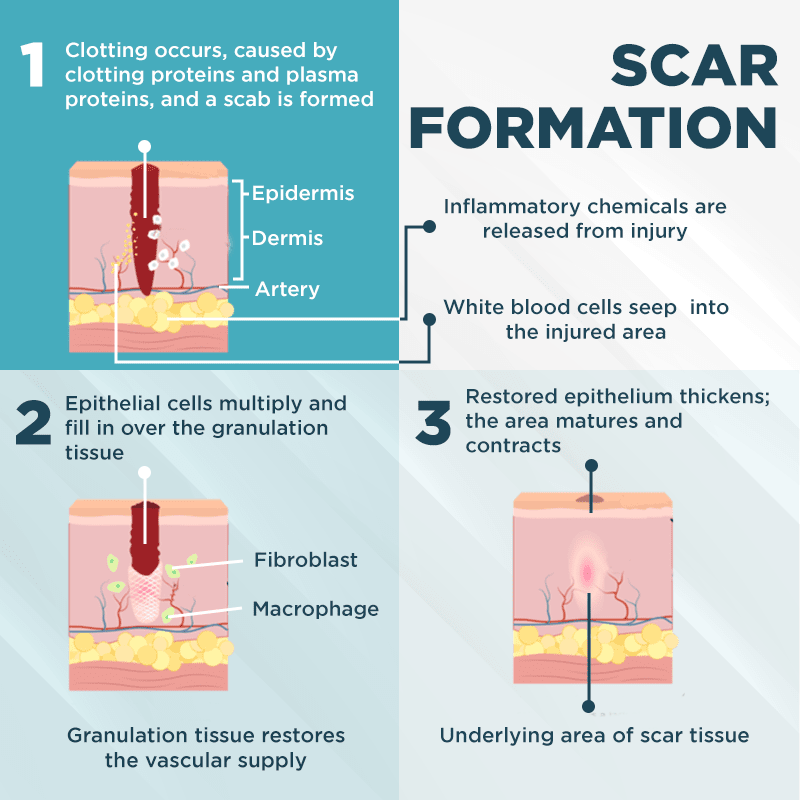 ClearScar™ Gel réducteur de cicatrices avancé