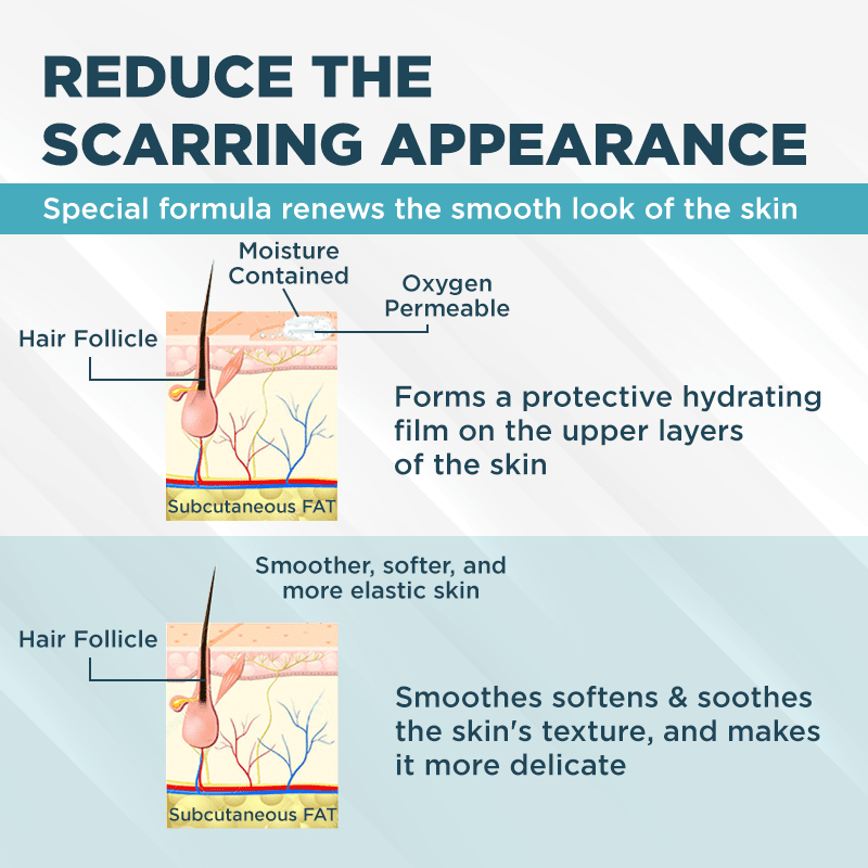 ClearScar™ Gel réducteur de cicatrices avancé