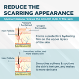 ClearScar™ Advanced Scar Reduction Gel