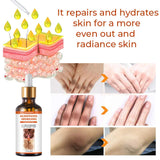 GFOUK™ Acanthosis Nigricans Therapy Oil