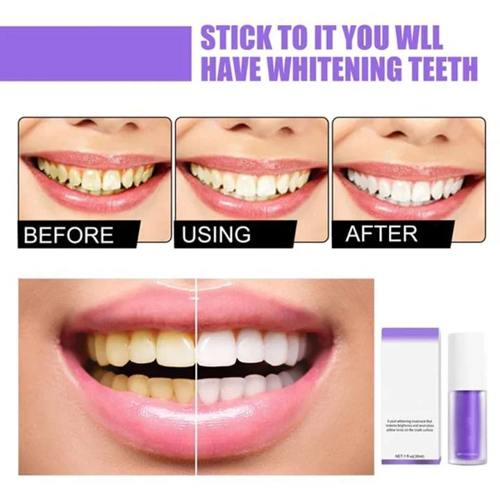 SÉRUM CORRECTEUR DE COULEUR DES DENTS