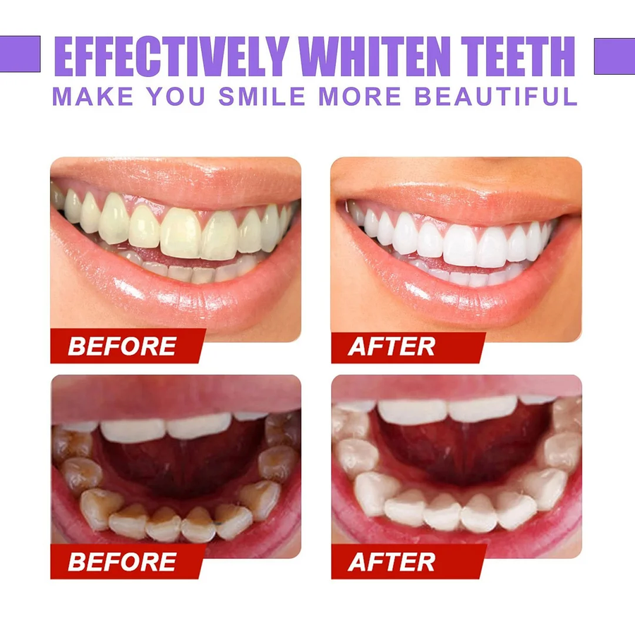 SÉRUM CORRECTEUR DE COULEUR DES DENTS